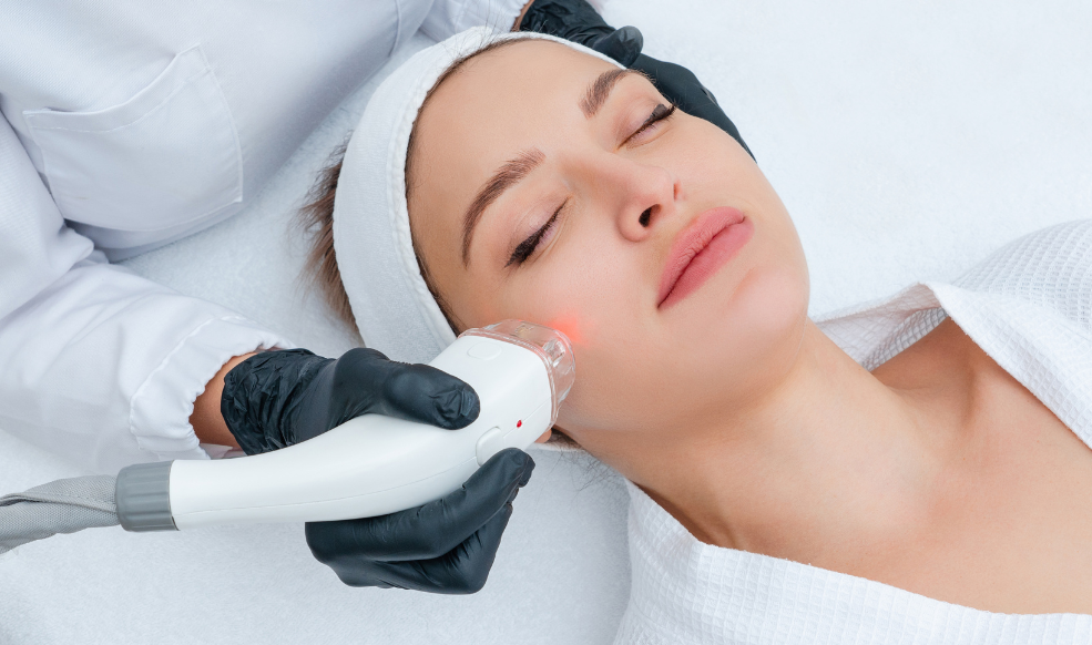 Laser Collagen Facial